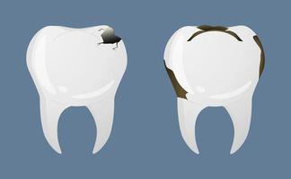 dientes en estilo realista. iconos de caries dental. Ilustración de vector colorido aislado sobre fondo.