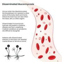 mucormicosis diseminada ilustración vectorial gráfico informativo vector