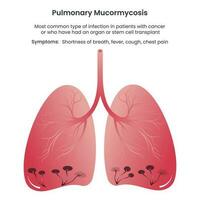 mucormicosis pulmonar ilustración vectorial gráfico informativo vector