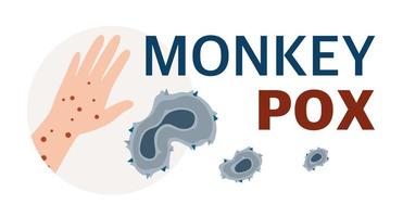 Monkey Pox virus Poster to inform about the pandemic and spread of the disease Images of human virus and monkey Vector Illustration