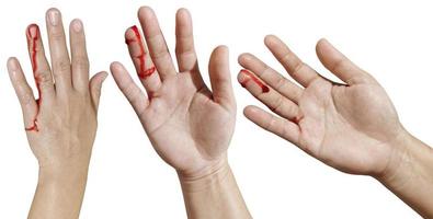 la mano de una mujer ensangrentada representa lesiones, accidentes en un fondo blanco foto