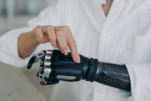 Woman with disability turns on high tech prosthetic arm, showing bionic prosthesis, close-up photo