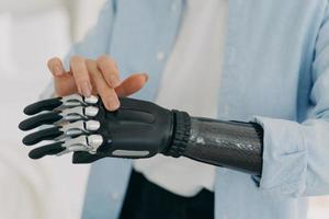 Disabled female touches high tech artificial arm limb, close up. Bionic hand prosthesis advertising photo