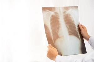 radiografía de los pulmones es donde se dirigen los rayos x foto