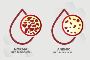 anemia hierro glóbulos rojos medical vector ilustración médica.