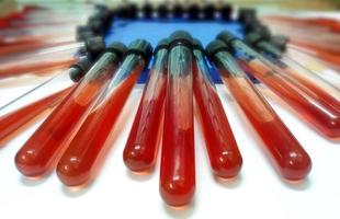 Sheep blood in glass tube after autoclaving which is ready for using as blood agar media in microbial culture. photo