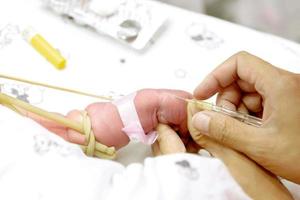 la imagen de las manos de la enfermera utiliza gradualmente el catéter intravenoso en las manos del bebé enfermo para preparar la solución salina y el medicamento. foto