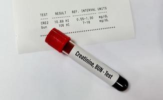 Blood sample tube isolated for Creatinine and BUN with abnormal report for the diagnosis of Kidney Function test. photo