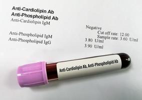 prueba anti-cardiolipina ab y anti-fosfolípido ab, diagnóstico de trastorno autoinmune foto