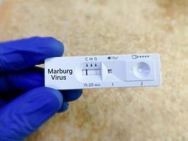 Marburg virus IgG positive result by using rapid test cassette photo