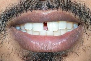 Happy smile with teeth macro close-up view photo