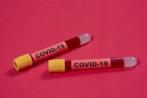 tubo de vacío con sangre y la palabra covid-19 en la etiqueta de identificación. foto