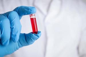 A scientist or researcher in a laboratory holds a test tube to invent a vaccine against the coronavirus. Concept of treatment Medical experiments prevent the spread of the covid-19. photo