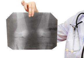 enfermera sostiene una imagen de rayos X con la articulación de la rodilla humana foto