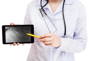 nurse points on tablet pc with vertebral column photo