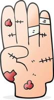 cartoon injured hand vector