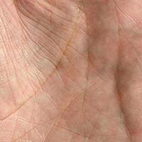 Close up of human hand skin with visible skin texture and lines photo