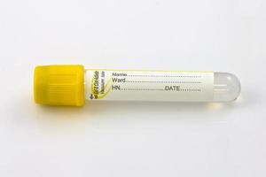 test tube with yellow plug  isolated on white background photo