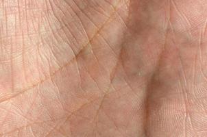 Close up of human hand skin with visible skin texture and lines photo