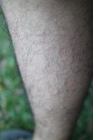 the skin texture of a man's feet is brown full of fur photo