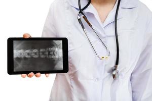 enfermera sostiene tablet pc con columna vertebral humana foto