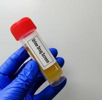 Lab technician holds Urine sample for drug screen test, for the detection of certain illegal drugs in urine. photo