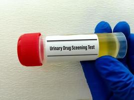 Lab technician holds Urine sample for drug screen test, for the detection of certain illegal drugs in urine. photo