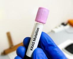 Molecular Biologist hold blood sample for  KRAS mutation test for lung cancer. photo