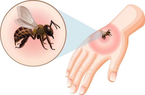 bee sting clipart