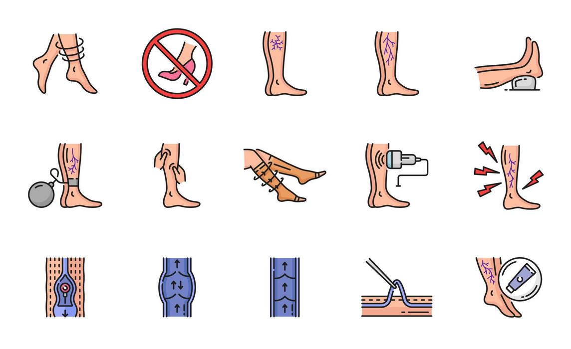 Thrombosis Diagnosis Vector Art, Icons, and Graphics for Free Download