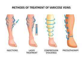 Methods Of Treatment Of Varicose Veins vector