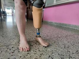 Disabled young women try to walk with prosthetics photo