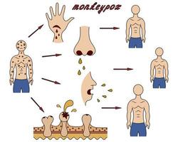 The route of infection and the mechanism of transmission to humans of the monkeypox virus in cartoon style vector