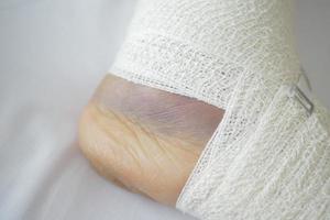 Woman with bandaged foot on bed photo