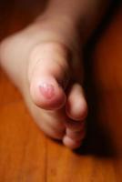 close up of 5 years old child injured feet on floor photo