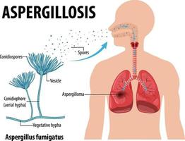 diagrama que muestra la infección por aspergillus vector