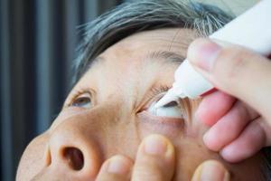 Doctor apply artificial tears gel to senior woman patient eye for treatment dry eye photo