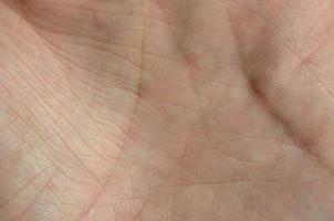 Close up of human hand skin with visible skin texture and lines photo
