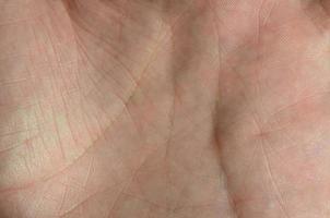 Close up of human hand skin with visible skin texture and lines photo