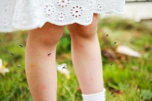 linda niña asiática tiene erupción cutánea y alergia por picadura de mosquito y chupa sangre en las piernas mientras juega en el campo de hierba verde al aire libre foto