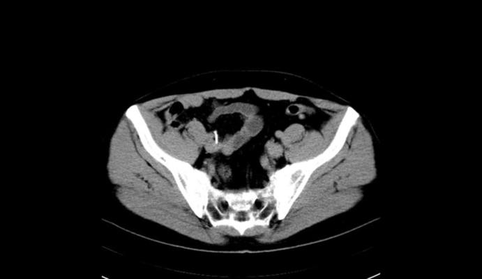 Ct Scan Stock Photos, Images and Backgrounds for Free Download Biology Diagrams