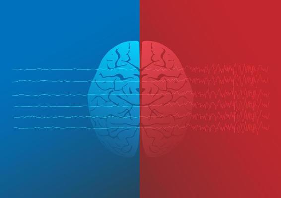 Illustration of human normal brain and epileptic brain. Brain waves of focal seizure.