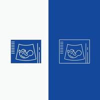 Maternity. pregnancy. sonogram. baby. ultrasound Line and Glyph web Button in Blue color Vertical Banner for UI and UX. website or mobile application vector