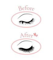 Eyelash extension. Improper eyelash extensions. Consequences of eyelash extensions. Harmful preparations for eyelashes. vector