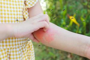 Little girl has skin rash allergy and itchy on her arm from mosquito bite photo
