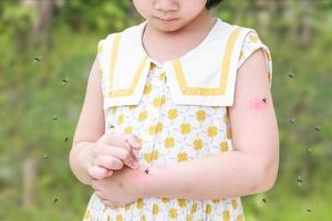 Little girl has skin rash allergy itching and scratching on her arm with mosquitoes bite photo