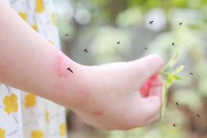 la niña tiene alergia a la erupción cutánea, picazón y rascado en el brazo con picadura de mosquitos foto