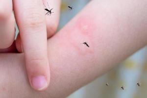 la niña tiene alergia a la erupción cutánea, picazón y rascado en el brazo con picadura de mosquitos foto