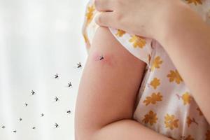 Little girl has skin rash allergy and itchy on her arm from mosquito bite photo