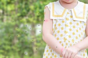 la niña tiene alergia a la erupción cutánea, picazón y rascado en el brazo con picadura de mosquitos foto